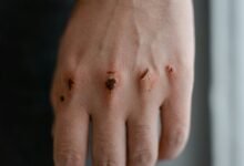 qexilkizmor for sensitive skin