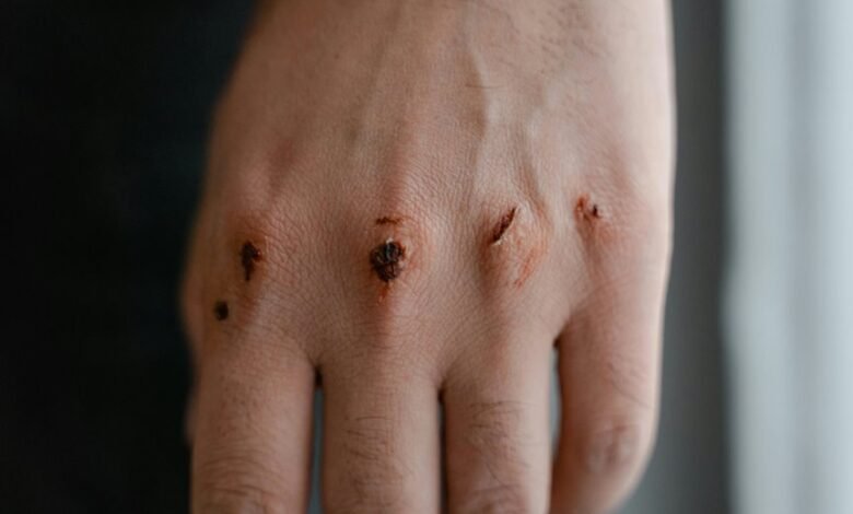 qexilkizmor for sensitive skin